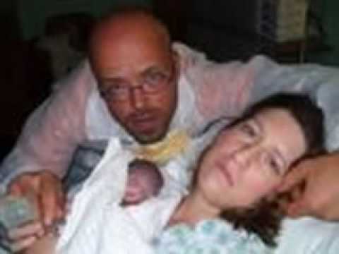 trisomy 18 syndrome. Take on Trisomy 18