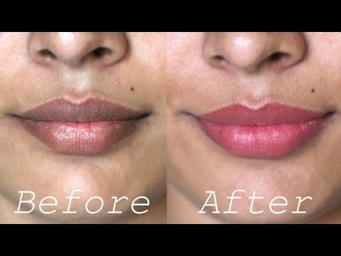 how to whiten dark lips