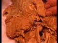 Anatomy: 7th Cranial Nerve