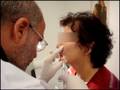 videos de Naso-labial wrinkle correction by.Dr.Ardeshir Vahidi