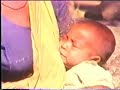Open My Eyes Part 1 Rural Health And Rural Areas
