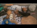 Tanzania albinos face violence - 25 Jun 08
