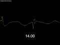 9/11 Debunked: World Trade Center - No Free-Fall Speed