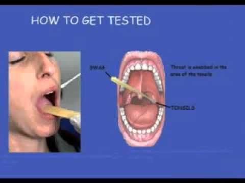 how to pass a group b strep test