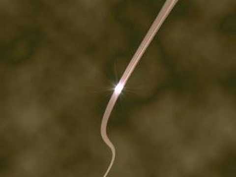 Micturition - I created this animation back in 2004 for Novartis. The animation explains the micturition reflex.