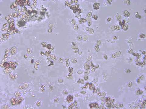 how to isolate monocytes from pbmc