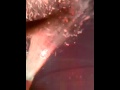 PUS