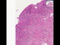 Histopathology-Vagin