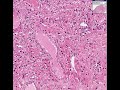 Histopathology-Vagin
