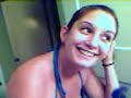 Bald girl