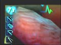 Trauma center Under the knife 5-3 Shifting GUILT (Speedrun) Trauma center Under the knife 5-3 Shifting GUILT (Speedrun)
