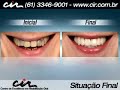 15 - Tratamento integrado Cl�nica CIR Bras�lia