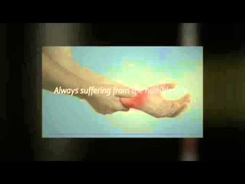 how to cure arthritis in feet