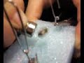 Video from My Phone (10 volt 16 rings.3g2)