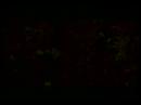 KREATOR:hallucinative comas pt 16 of 18