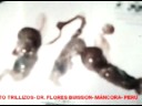 No al aborto inducido-daniel calveti, 