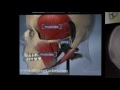 West Los Angeles Chiropractor Provides TMJ/Jaw Pain Relief