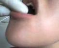 perforaciones lunatiko