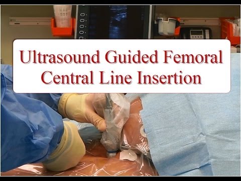 how to administer ultrasound