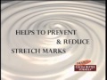 PALMER'S STRETCH MARKS ( SG MANDARIN VERSION)