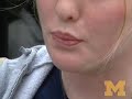 Surgery creates usable tongue following oral cancer