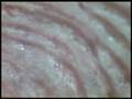 eccrine sweat gland