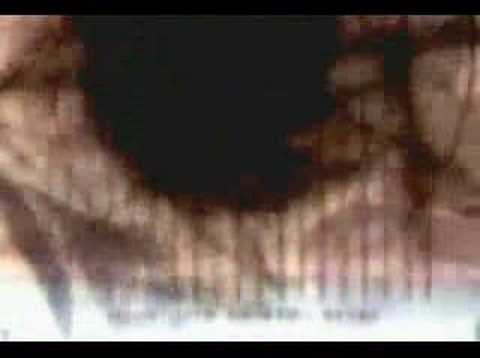 Sweet Misery: A Poisoned World