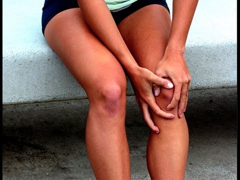 how to relieve knee pain from running