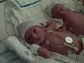 The Twins - A Few Hours Old