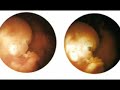 Phil Keaggy 'Little Ones' (Miracle of Life)