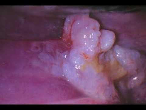 Atlas of Gynecology