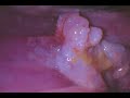 Atlas of Gynecology Atlas of Gynecology
