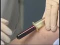 blood sampling technics