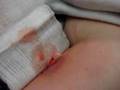 YouTube - E.R. "Staph" II