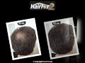 Nuova risoluzione per infoltire i capelli !!! HairFor2