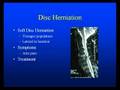Neck or Arm Pain from Disc Herniation, Arthritis or Stenosis