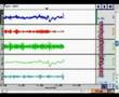 Brainwave Teknologi Gelombang Otak