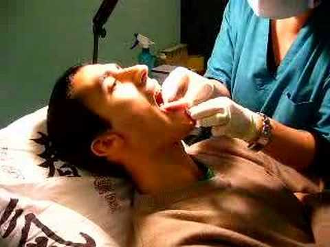 Il mio piercing alla lingua eseguito in modo perfetto da Fosca a Vercelli!