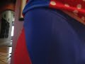 This is my hip squeaking as a result of a Stryker ceramic-on-ceramic titanium hip replacement surgery. Do you think Stryker has a problem?!?