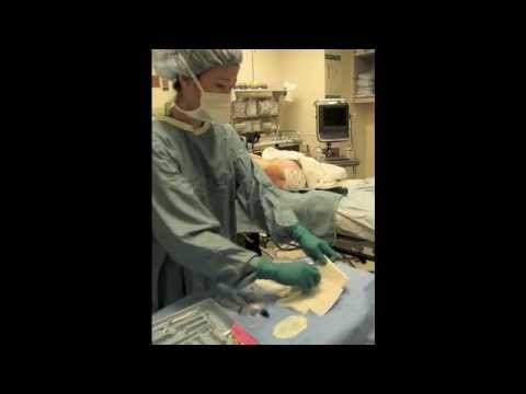 how to measure epidural catheter