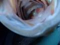 Julio Isidro Catches Bass with Carp in Mouth