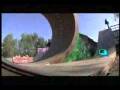 MTV Scarred Tony Hawk