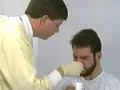 Nasogastric Intubation Nasogastric Intubation