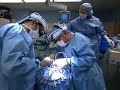 Podcast: Posterior Fossa Craniotomy for Brain Tumor