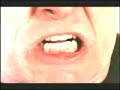 Thumbnail #3