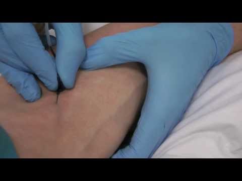 how to collect blood by venipuncture