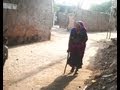 Fluorosis Bends Rural Gujurat at the Knees