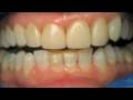 LVI Smile Cosmetic Dentists 6