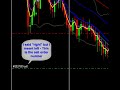 Stop loss- Profit Protection in Forex - Forex Training Video