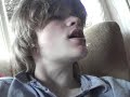 apple head callum burgess